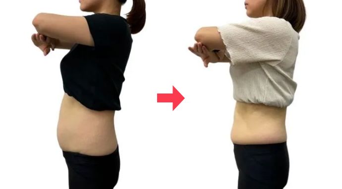 20代女性 ビフォーアフター 週に2回：3ヶ月の変化