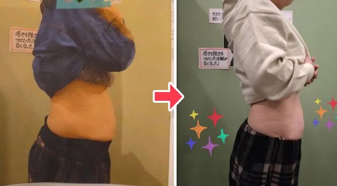 30代女性 ビフォーアフター 週に2回：2ヶ月の変化