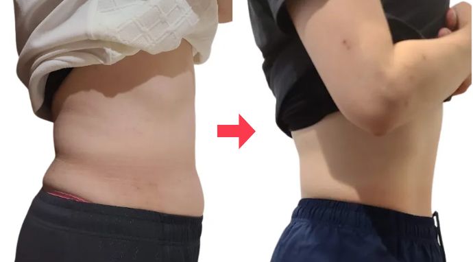 40代女性 ビフォーアフター 週に1回：1ヶ月の変化